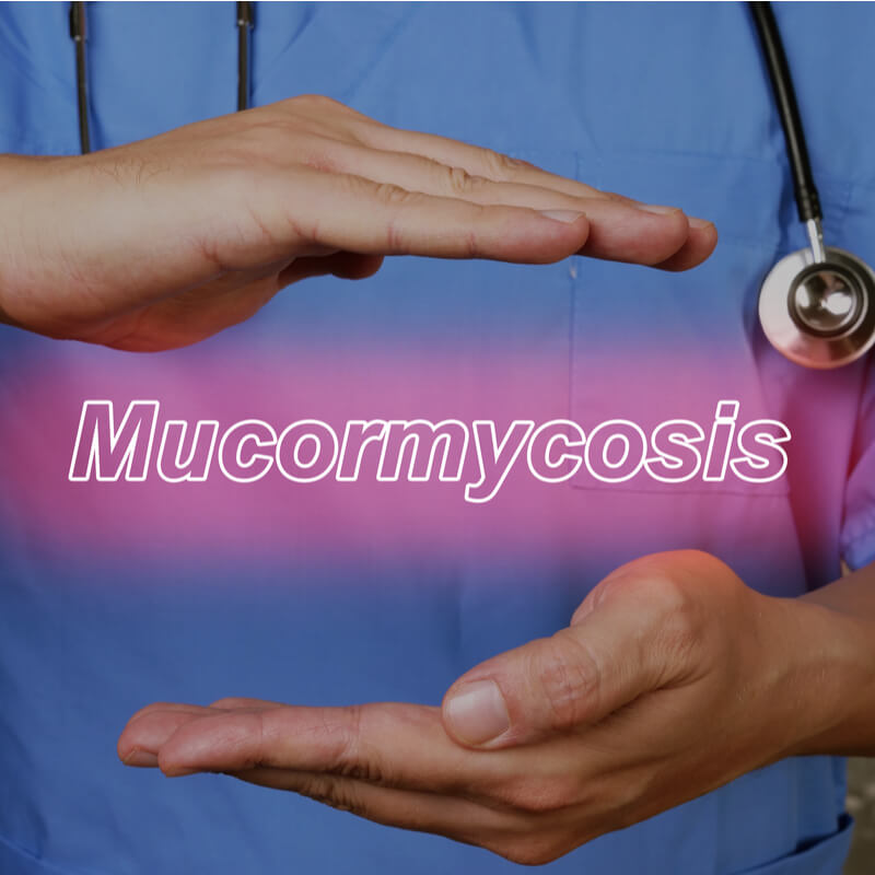 You are currently viewing Mucormycosis: A new Epidemic in making?